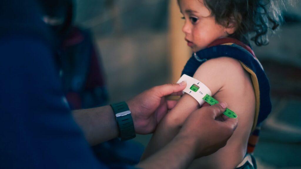 Nothilfe in einem Krisengebiet: Ein Kleinkind wird mit einem Massband auf Unterernaehrung untersucht – medizinische Soforthilfe fuer Kinder