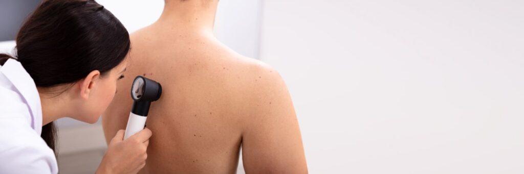 Dermatologin untersucht Rueckenhaut eines Patienten mit einem Dermatoskop, um Pigmentflecken entfernen oder beurteilen zu koennen.